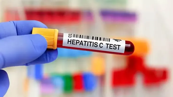 HEC Commits to Free Hepatitis C Tests at Federal Campuses