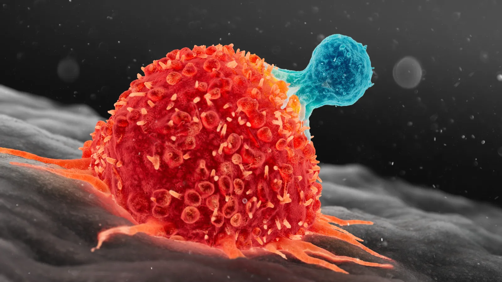 Study Finds High Blood Sugar May Boost Immune Attack on Certain Cancers