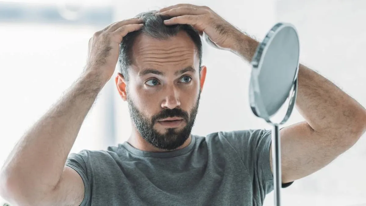 Experimental Pill Restores Men's Hair Within Six Months