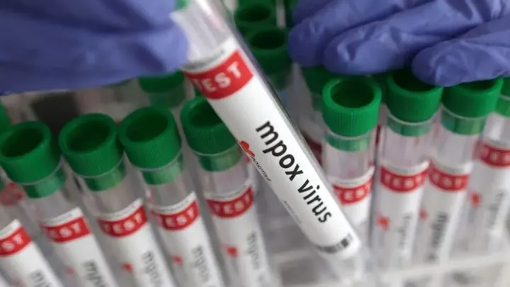 Karachi Private Hospital Sealed After Newborn Contracts Mpox From Circumcision