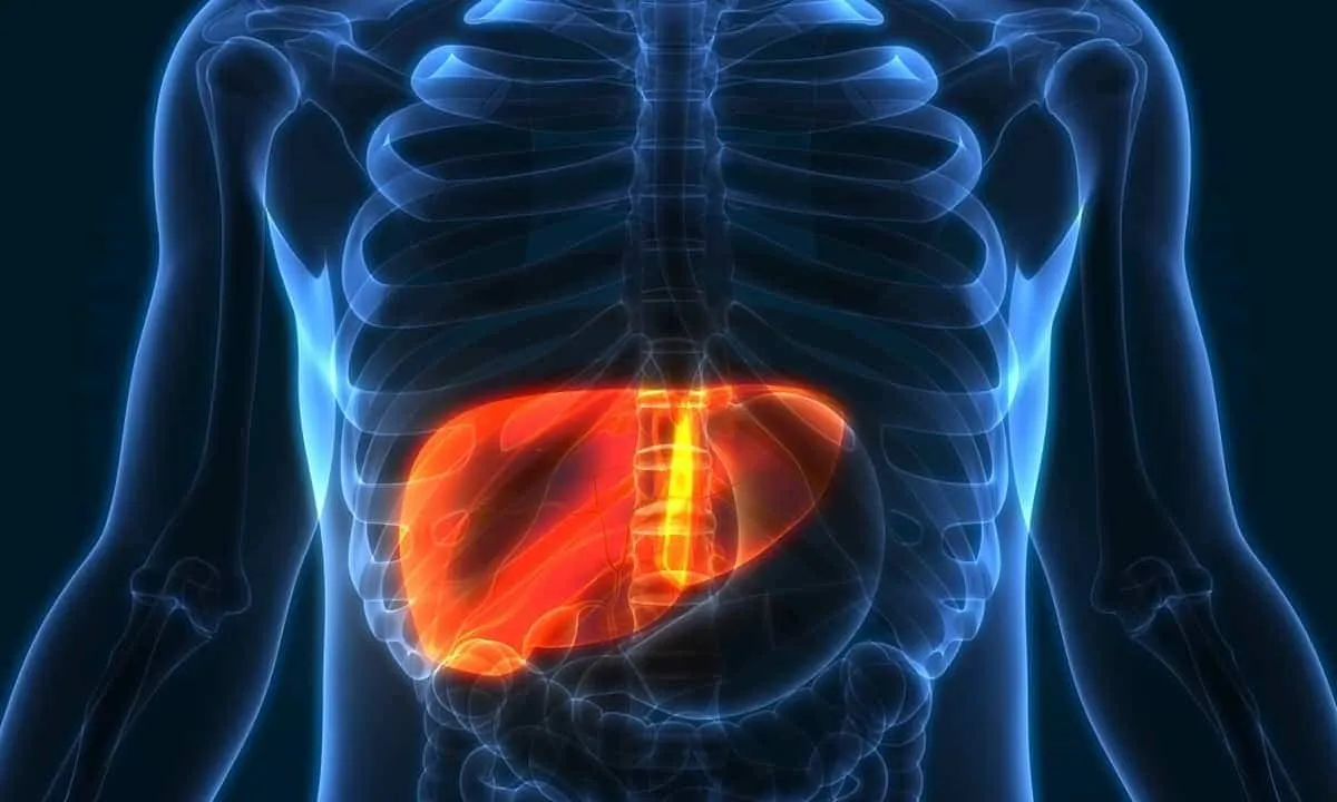 Thirty-One New Genetic Regions Connected to Fatty Liver Disease Found